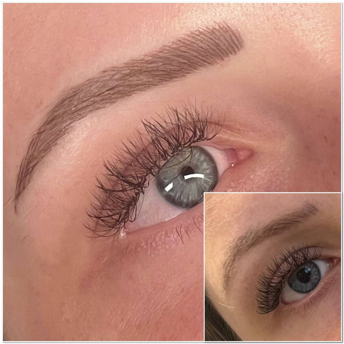 Before after 1