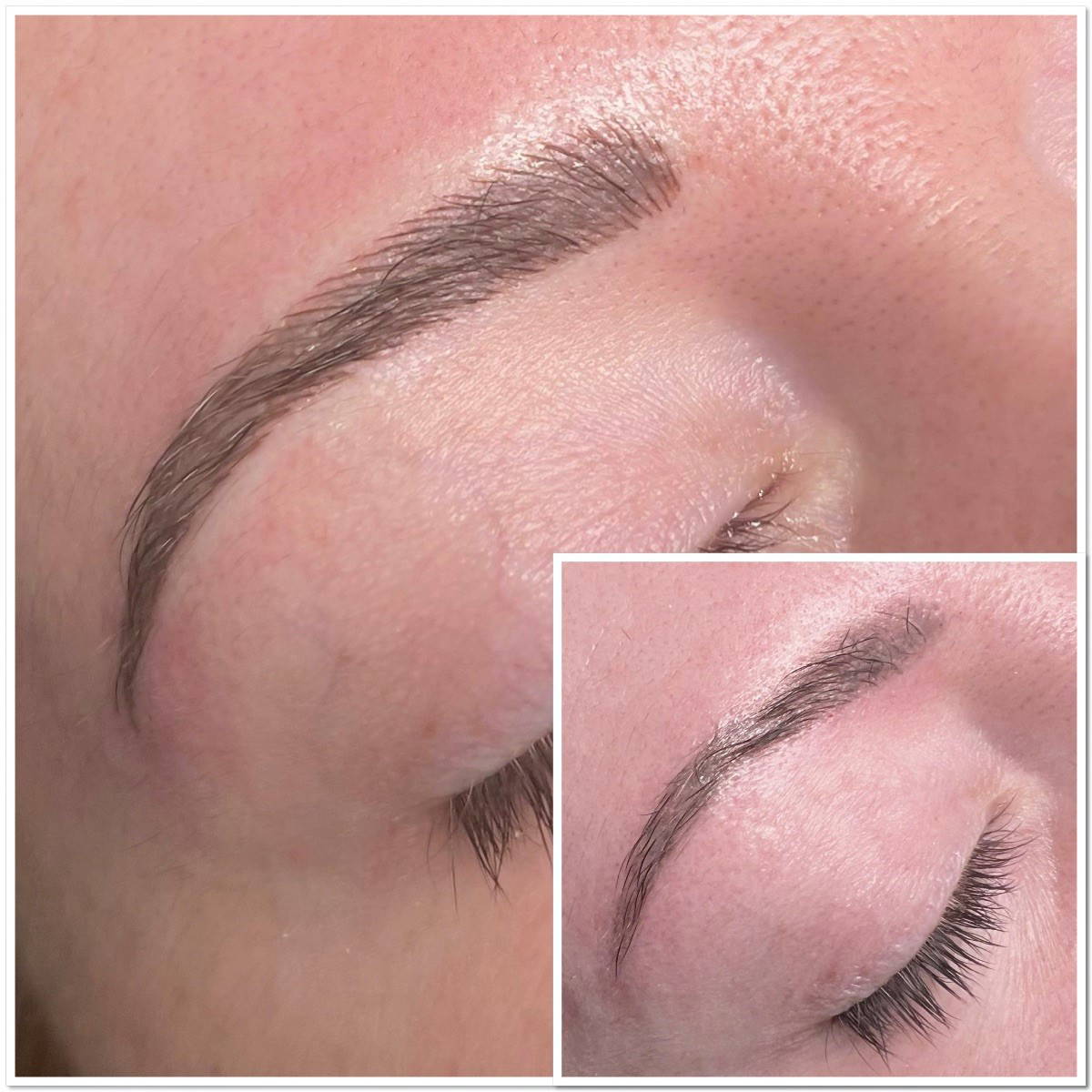 Before after 2