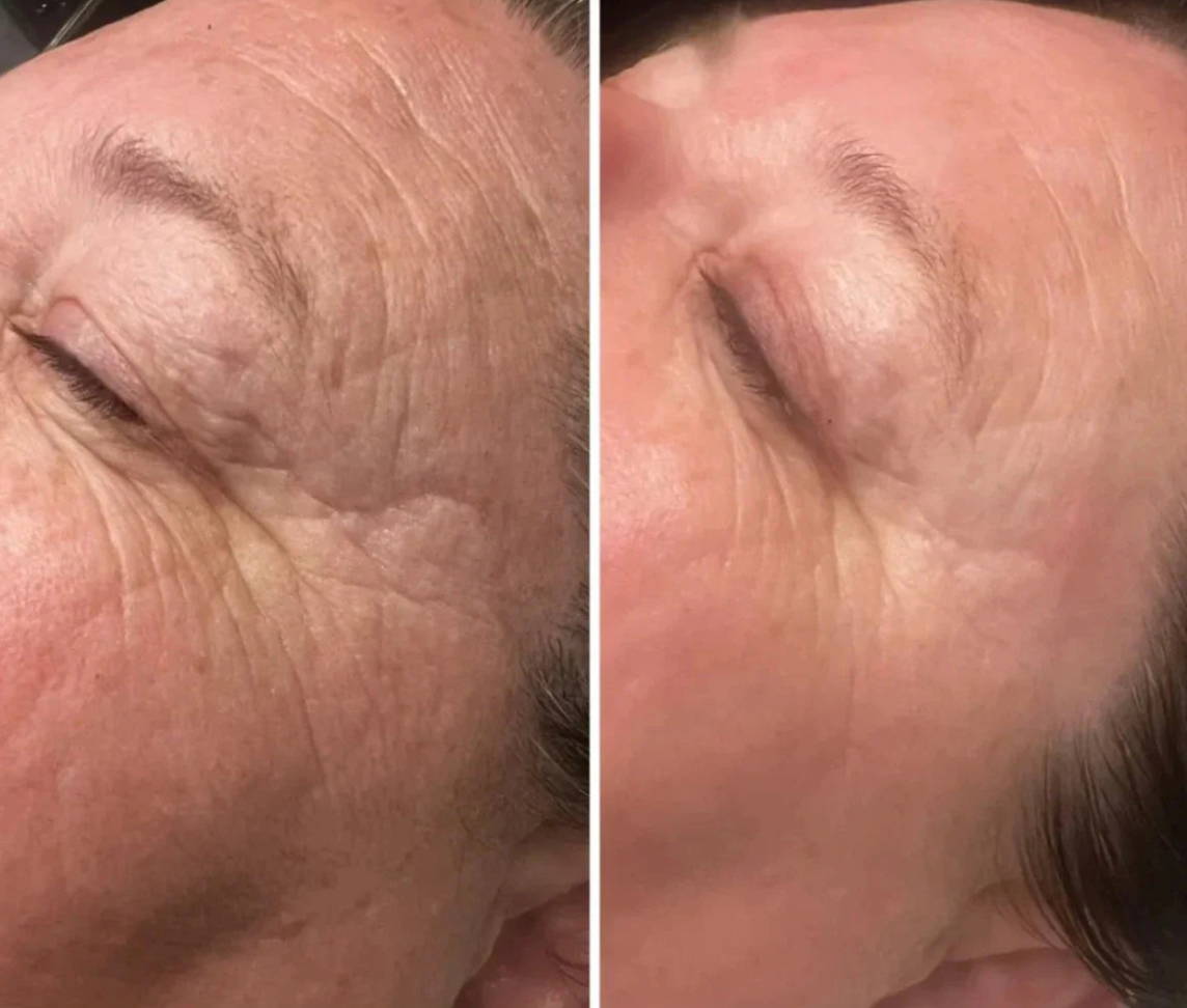 Before and After 1