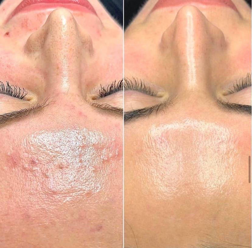 Before and After 3
