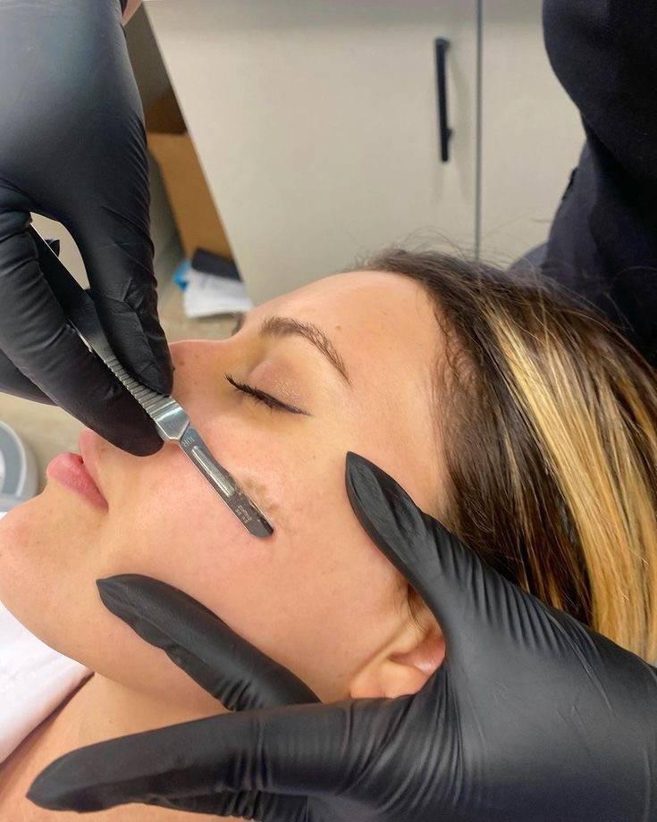 Dermaplaning June
