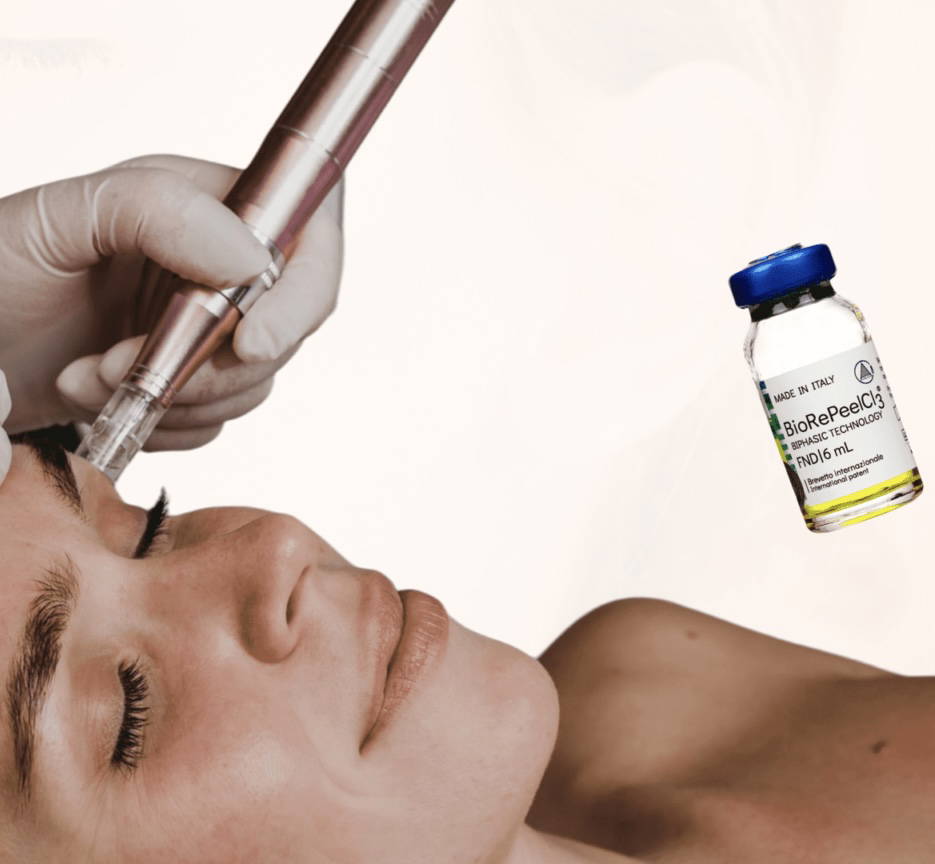 Image for BioRePeel + Microneedling