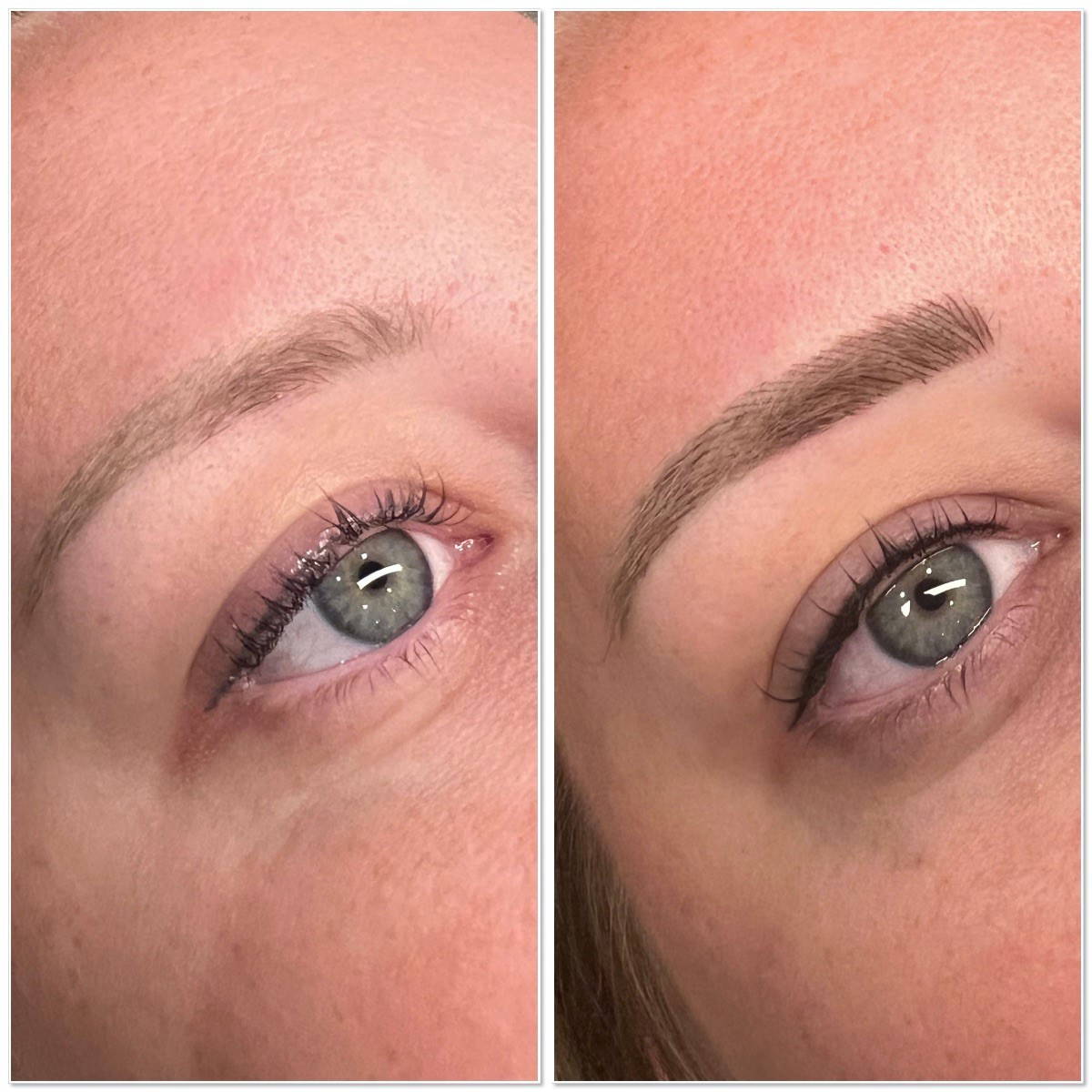 before after 3