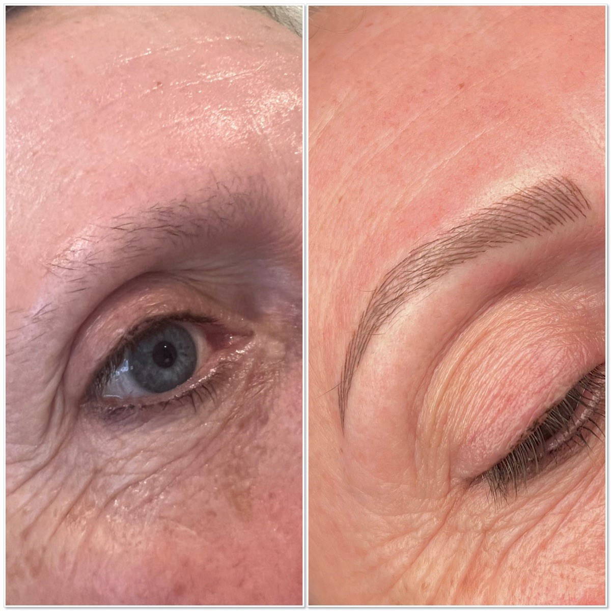 before after 4