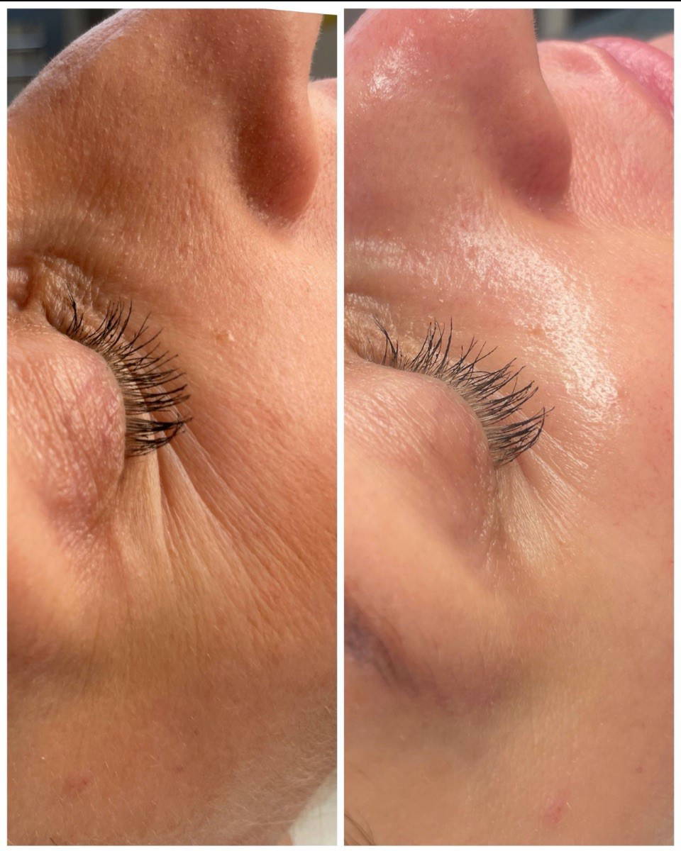 Before and After 1