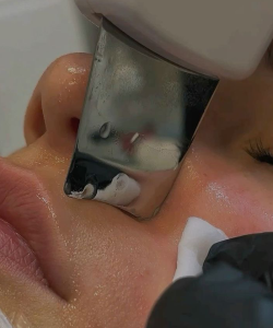 Facial 1