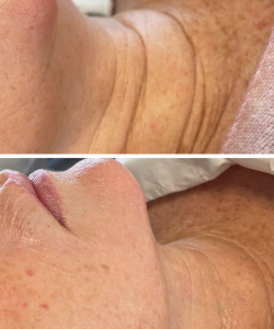 Skin 1