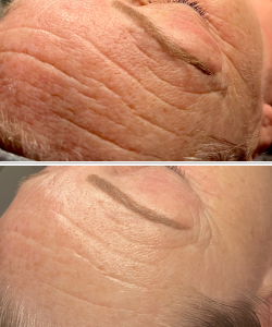 Skin 2